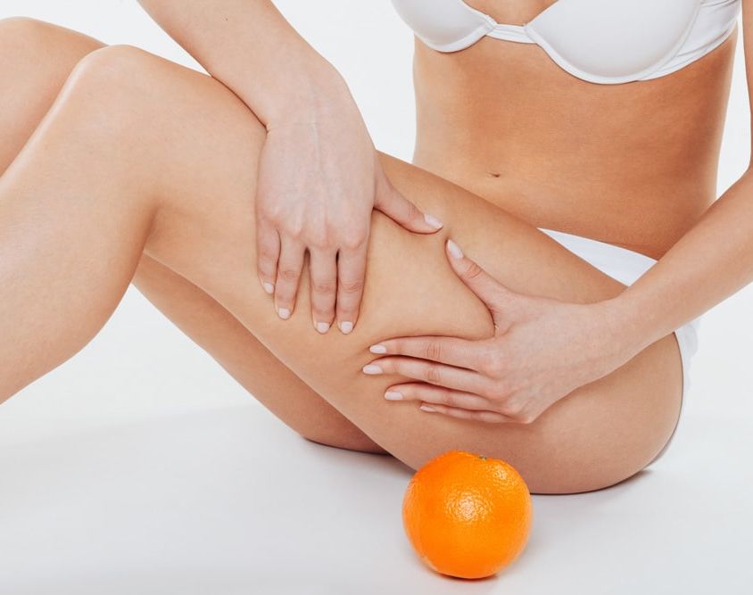 Cellulite ist auch bekannt als "Orangenhaut" - Wellcotec Blog